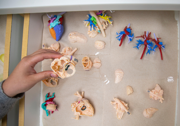 3D Printed Heart Models from CHRISTUS Children's